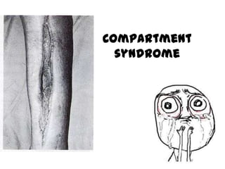 Casts and tractions | PPTX