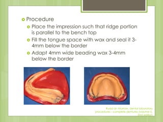  Procedure
 Place the impression such that ridge portion
is parallel to the bench top
 Fill the tongue space with wax and seal it 3-
4mm below the border
 Adapt 4mm wide beading wax 3-4mm
below the border
Rudd an Morrow, dental laboratory
procedures - complete dentures (volume I),
2nd edition
 