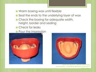  Warm boxing wax until flexible
 Seal the ends to the underlying layer of wax
 Check the boxing for adequate width,
height, border and sealing
 Check for leaks
 Pour the impression
Rudd an Morrow, dental laboratory
procedures - complete dentures (volume I),
2nd edition
 
