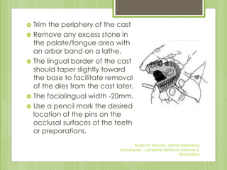  Trim the periphery of the cast
 Remove any excess stone in
the palate/tongue area with
an arbor band on a lathe.
 The lingual border of the cast
should taper slightly toward
the base to facilitate removal
of the dies from the cast later.
 The faciolingual width -20mm.
 Use a pencil mark the desired
location of the pins on the
occlusal surfaces of the teeth
or preparations.
Rudd an Morrow, dental laboratory
procedures - complete dentures (volume I),
2nd edition
 