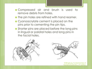  Compressed air and brush is used to
remove debris from holes.
 The pin holes are refined with hand reamer.
 Cyanoacrylate cement is placed on the
pins prior to cementing the pin tips.
 Shorter pins are placed before the long pins
in lingual or palatal holes and long pins in
the facial holes.
Shillingburg, Fundamentals of
fixedproshodontics, 3rd edition
 