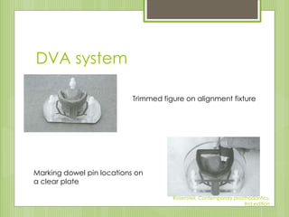 DVA system
Trimmed figure on alignment fixture
Marking dowel pin locations on
a clear plate
Rosensteil, Contemporary prosthodontics,
#rd edition
 