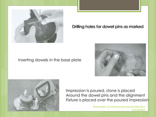 Drilling holes for dowel pins as marked
Inserting dowels in the base plate
Impression Is poured, stone is placed
Around the dowel pins and the alignment
Fixture is placed over the poured impression
Rosensteil, Contemporary prosthodontics,
#rd edition
Drilling holes for dowel pins as markedDrilling holes for dowel pins as markedDrilling holes for dowel pins as marked
 