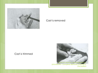 Cast is removed
Cast is trimmed
Rudd an Morrow, dental laboratory
procedures - complete dentures (volume I),
2nd edition
 