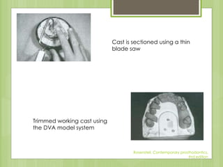Cast is sectioned using a thin
blade saw
Trimmed working cast using
the DVA model system
Rosensteil, Contemporary prosthodontics,
#rd edition
 