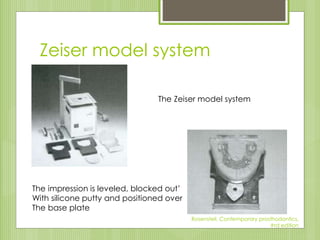 Zeiser model system
The Zeiser model system
The impression is leveled, blocked out’
With silicone putty and positioned over
The base plate
Rosensteil, Contemporary prosthodontics,
#rd edition
 