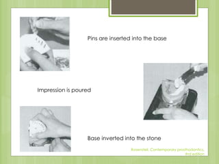 Pins are inserted into the base
Impression is poured
Base inverted into the stone
Rosensteil, Contemporary prosthodontics,
#rd edition
 