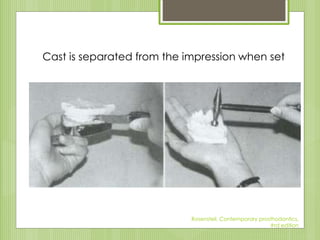 Cast is separated from the impression when set
Rosensteil, Contemporary prosthodontics,
#rd edition
 