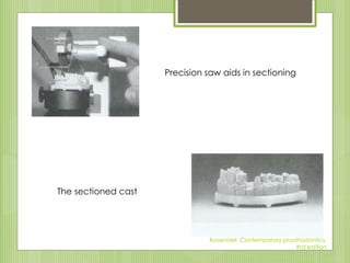 Precision saw aids in sectioning
The sectioned cast
Rosensteil, Contemporary prosthodontics,
#rd edition
 