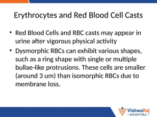 Disentagrating Rbc Cast Casts in Urine Analysis nephrology .pptx