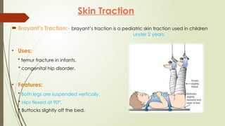 CAST,SPLINTS,TRACTION.pptx By Sanjay Acharya | PPTX