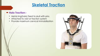 CAST,SPLINTS,TRACTION.pptx By Sanjay Acharya | PPTX