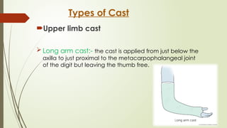 CAST,SPLINTS,TRACTION.pptx By Sanjay Acharya | PPTX