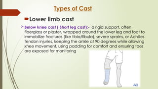 CAST,SPLINTS,TRACTION.pptx By Sanjay Acharya | PPTX
