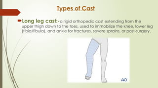 CAST,SPLINTS,TRACTION.pptx By Sanjay Acharya | PPTX