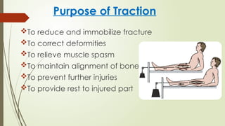 CAST,SPLINTS,TRACTION.pptx By Sanjay Acharya | PPTX