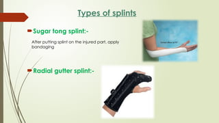 CAST,SPLINTS,TRACTION.pptx By Sanjay Acharya | PPTX
