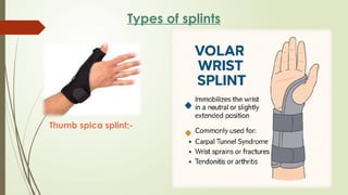 CAST,SPLINTS,TRACTION.pptx By Sanjay Acharya | PPTX
