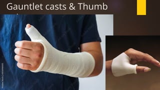 CASTS & SPLINTS types and picture (nursing).pptx