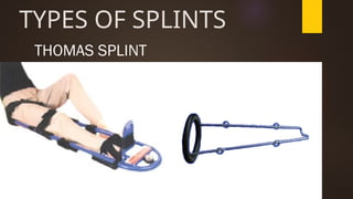 CASTS & SPLINTS types and picture (nursing).pptx
