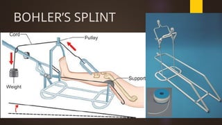 CASTS & SPLINTS types and picture (nursing).pptx