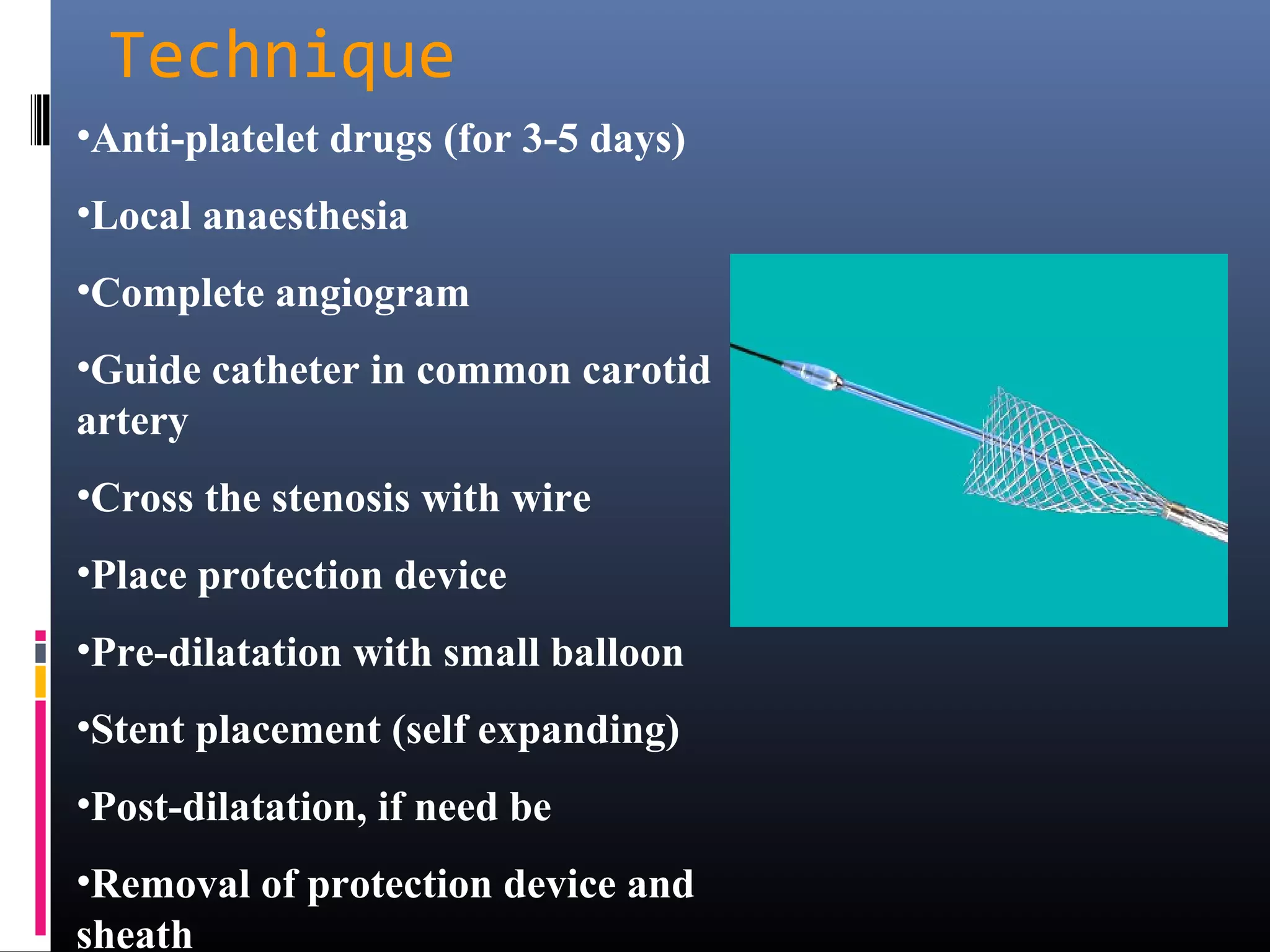 Carotid Artery Stenting | PPT