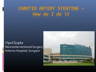 Vipul Gupta
Neurointerventional Surgery
Artemis Hospital, Gurgaon
 