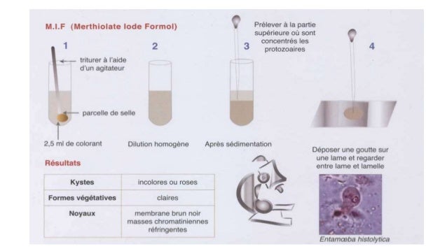 conduite a tenir devant un prélèvement de selles en parasitologie