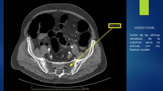 HUESO COXAL
Unión de las últimas
vértebras de la
columna sacra, se
articula con los
huesos coxales