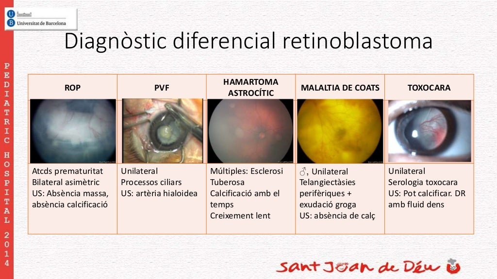 Diagnòstico diferencial del retinoblastoma