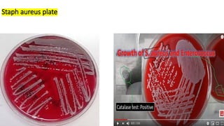 Comprehensive Guide to Catalase Test for Bacterial Identification | PPTX