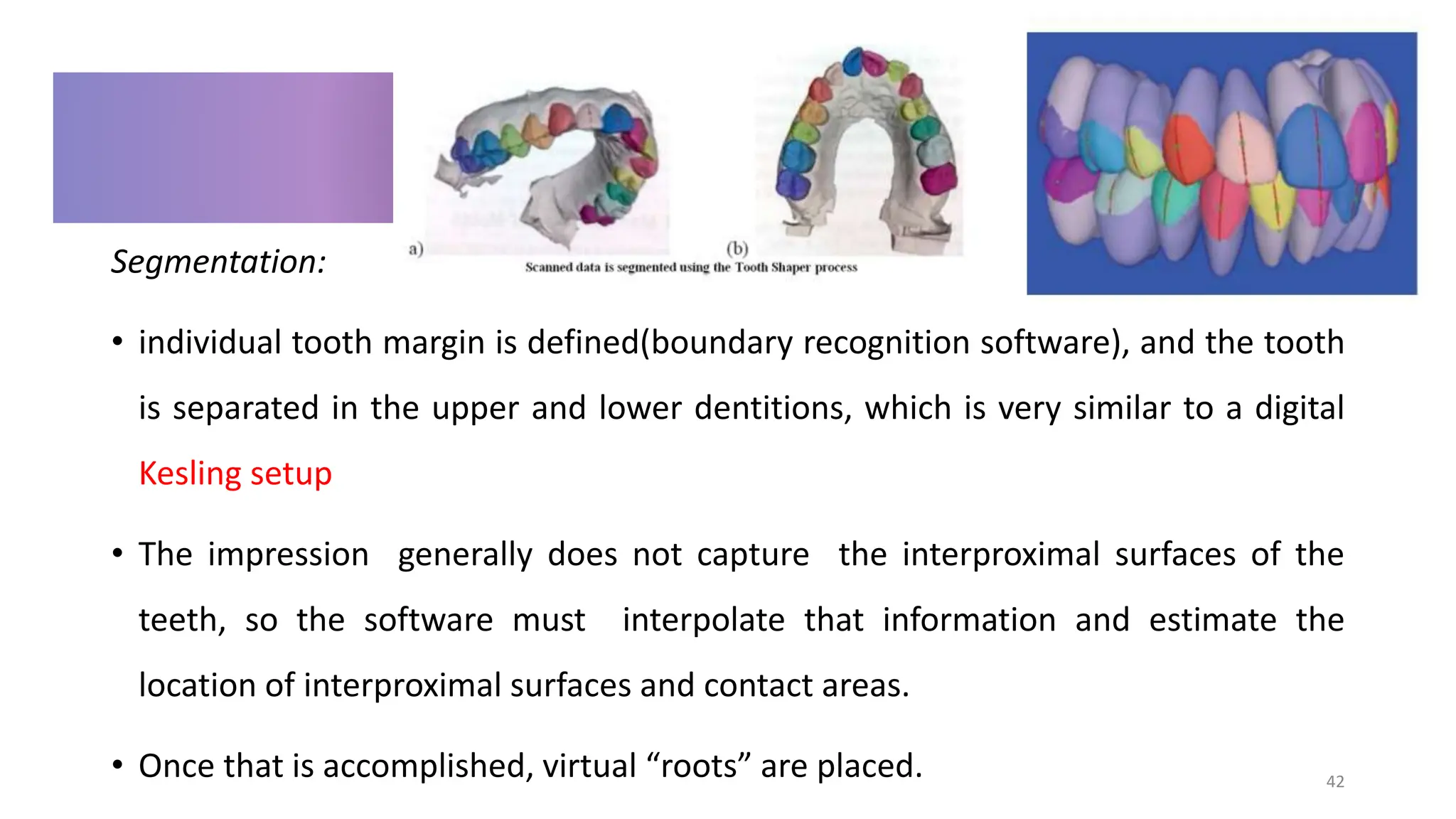 clear aligner in orthodontics a complete guid.pptx