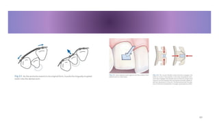 clear aligner in orthodontics a complete guid.pptx