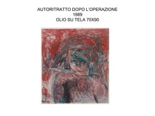 AUTORITRATTO DOPO L’OPERAZIONE
              1989
       OLIO SU TELA 70X90
 