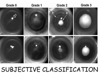 SUBJECTIVE CLASSIFICATION 