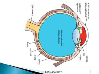 Cataract Structure Cataract | PPTX