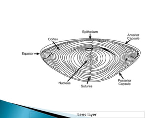 Cataract Structure Cataract | PPTX