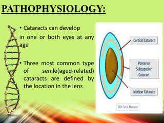 PATHOPHYSIOLOGY:
• Cataracts can develop
in one or both eyes at any
age
• Three most common type
of senile(aged-related)
cataracts are defined by
the location in the lens
 