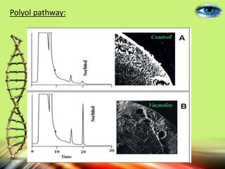 Polyol pathway:
 