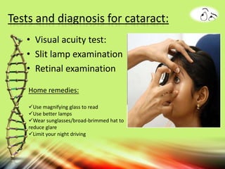 Tests and diagnosis for cataract:
• Visual acuity test:
• Slit lamp examination
• Retinal examination
nlm.nih.gov/medlineplusnlm.nih.gov/medlineplus
Home remedies:
Use magnifying glass to read
Use better lamps
Wear sunglasses/broad-brimmed hat to
reduce glare
Limit your night driving
 