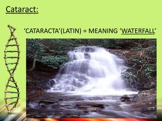 ‘CATARACTA’(LATIN) = MEANING ‘WATERFALL’
Cataract:
 