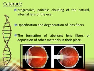 Cataract:
progressive, painless clouding of the natural,
internal lens of the eye.
Opacification and degeneration of lens fibers
The formation of aberrant lens fibers or
deposition of other materials in their place.
 