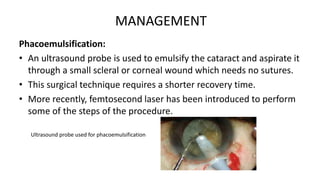 Phacoemulsification:
• An ultrasound probe is used to emulsify the cataract and aspirate it
through a small scleral or corneal wound which needs no sutures.
• This surgical technique requires a shorter recovery time.
• More recently, femtosecond laser has been introduced to perform
some of the steps of the procedure.
Ultrasound probe used for phacoemulsification
MANAGEMENT
 