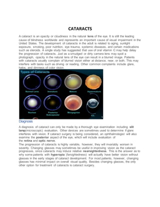 Cataract | DOCX