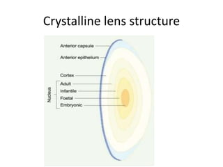 Cataract Structure Cataract | PPTX