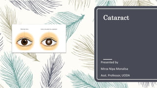 Cataract
Presented by
Mirza Nipa Monalisa
Asst. Professor, UODA
 