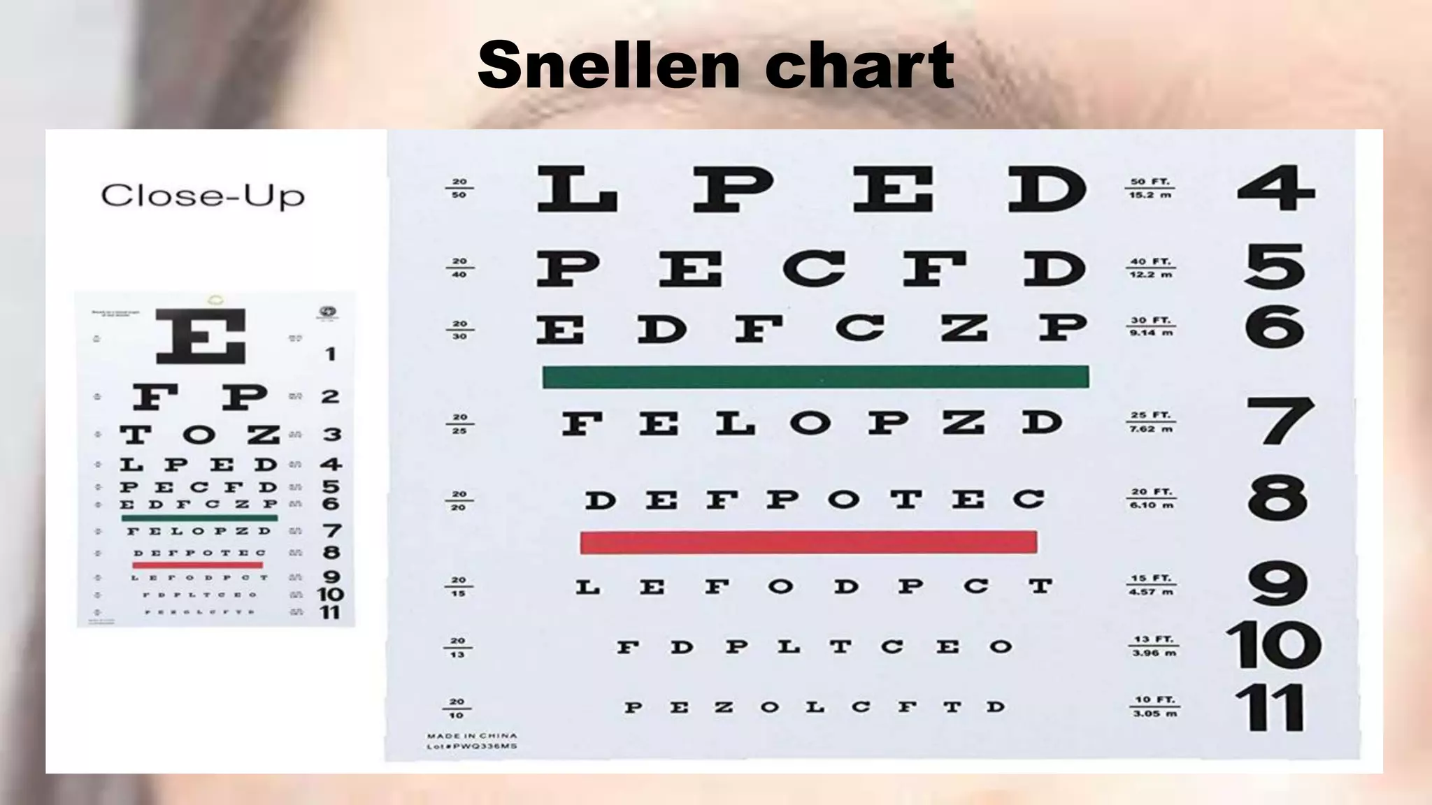 Snellen chart
 