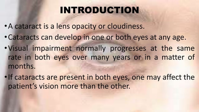 Cataract and its management | PPTX | Eye and Vision Conditions ...