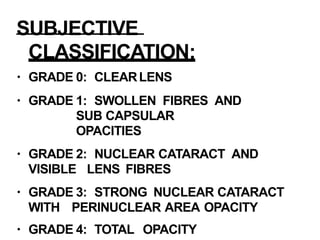 Cataract | PPTX