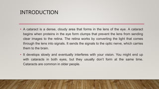 Cataract | PPTX